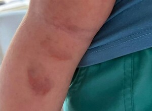 Следователи проверят сообщение о травмировании ребёнка в детском саду Холмска